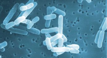 La tecnologia micro-riscaldamento per combattere il virus della Legionella